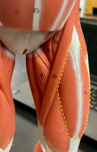 <p>What is the muscle outlined in yellow? Origin? Insert? Function?</p>
