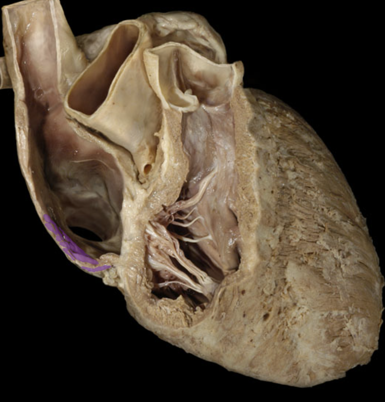 <p>Pectinate MM.</p>
