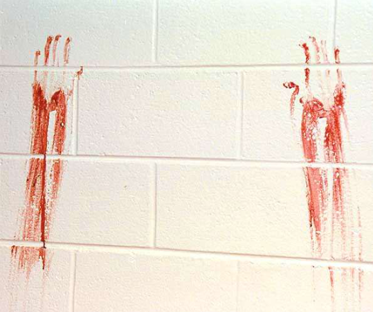 <p>What bloodstain pattern is this?</p>