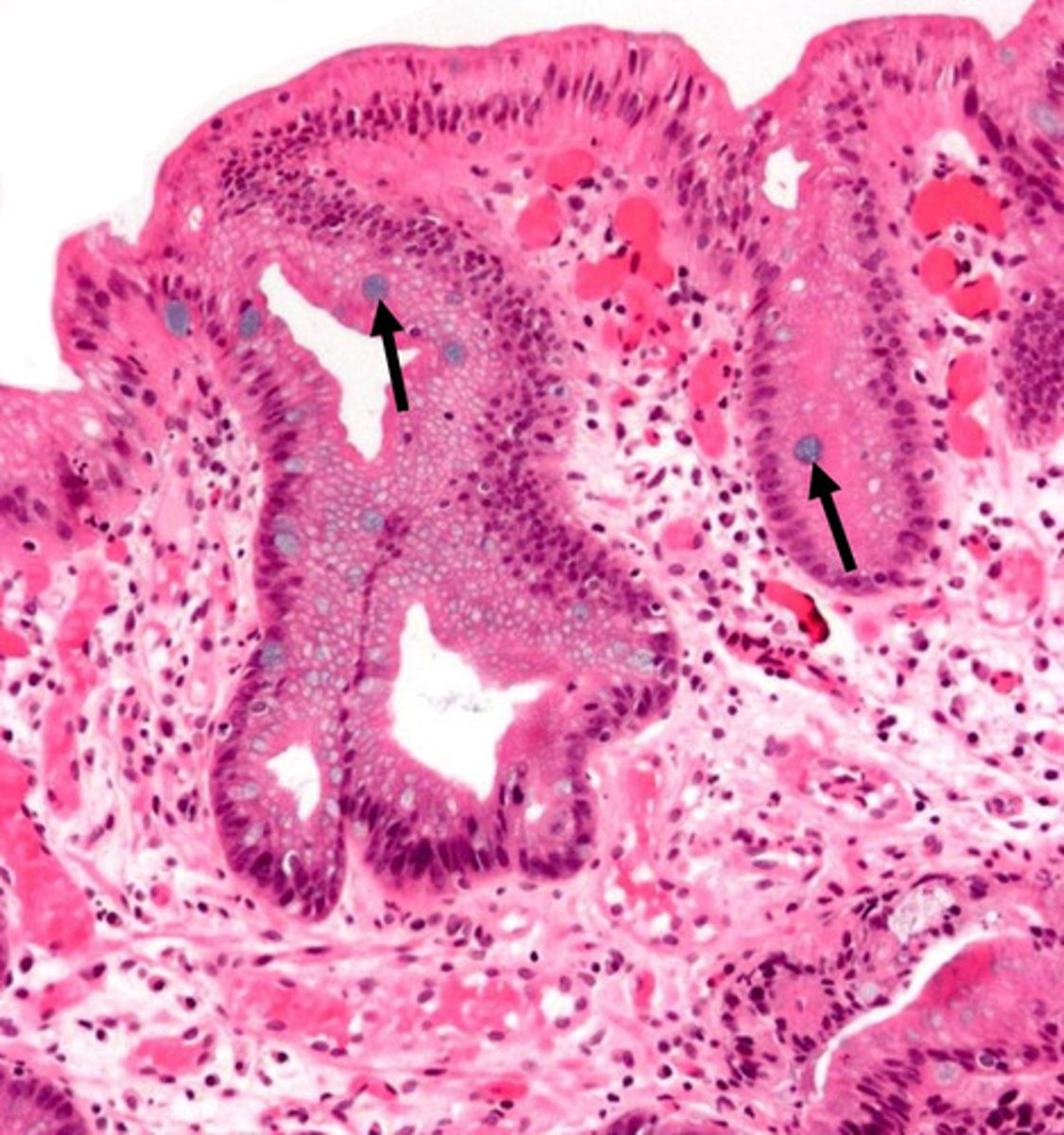 <p>goblet cell mucins stained with alcian blue</p>