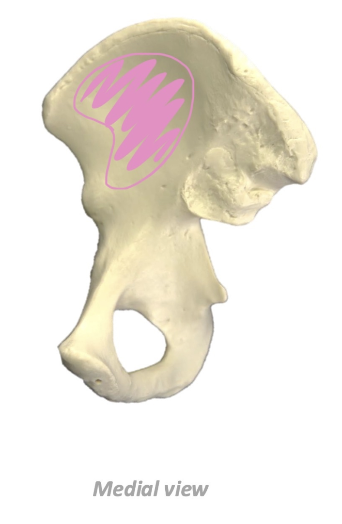 term image