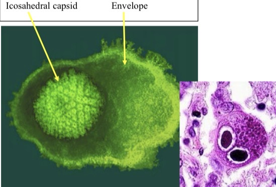 <p>Genus: Simplexvirus</p>