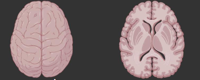 <p>What plane is this brain on?</p>