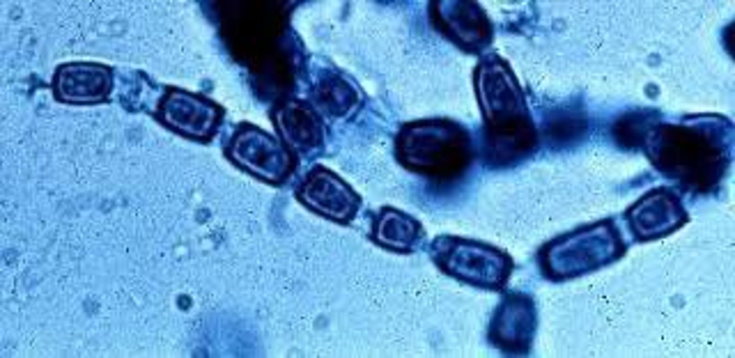 <p>Coccidioides immitis</p>