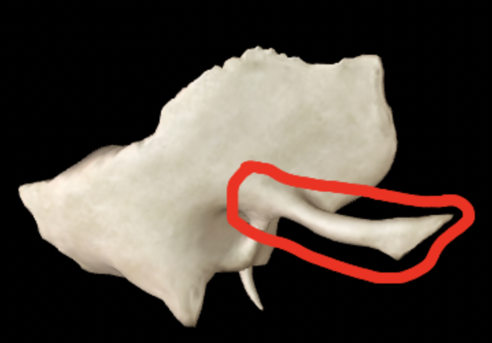 <p>What part of the temporal bone is this?</p>