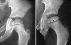 <p>Q what is the name of this measurement? and what is the average + range?</p>