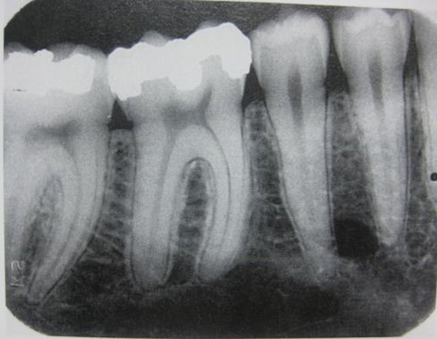 <p>what type of x-ray is this?</p>