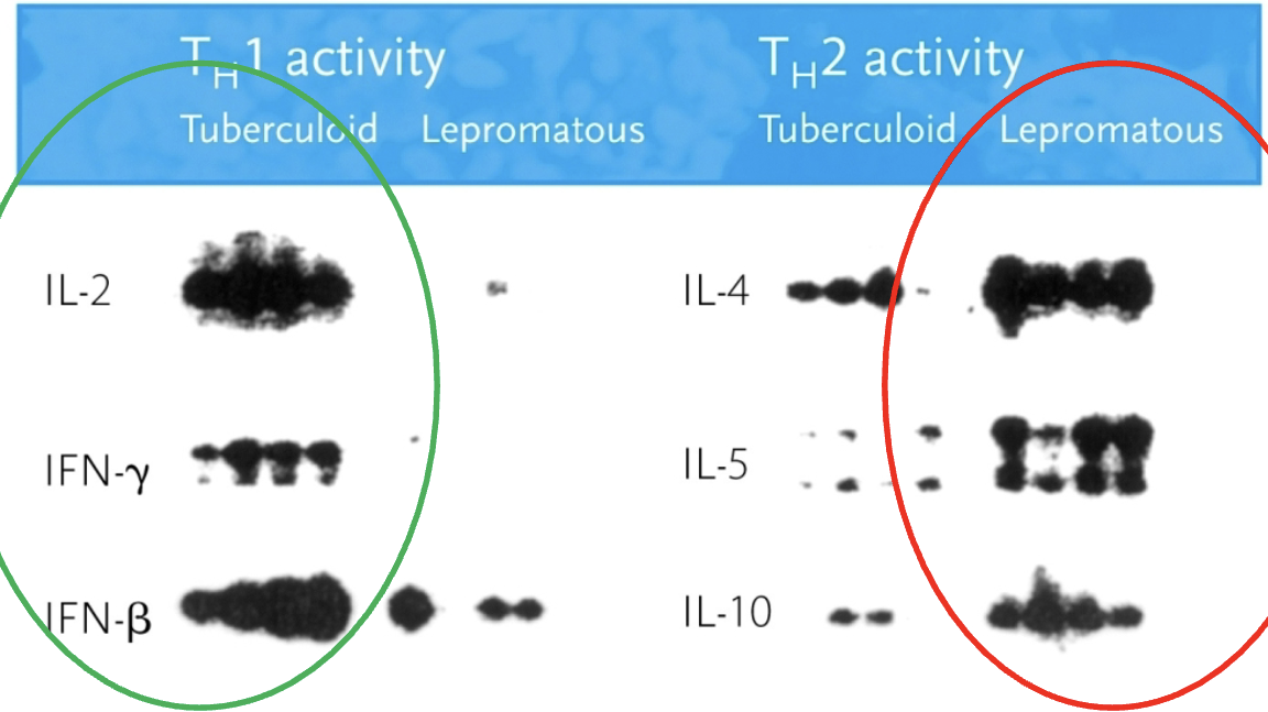 <p>T<sub>H</sub>1 activity (IL-2, IFN-y, IFN-<span>β) in tuberculoid leprosy. T</span><sub><span>H</span></sub><span>2 (IL-4, IL-5, IL-10) activity in lepromatous leprosy.</span></p>