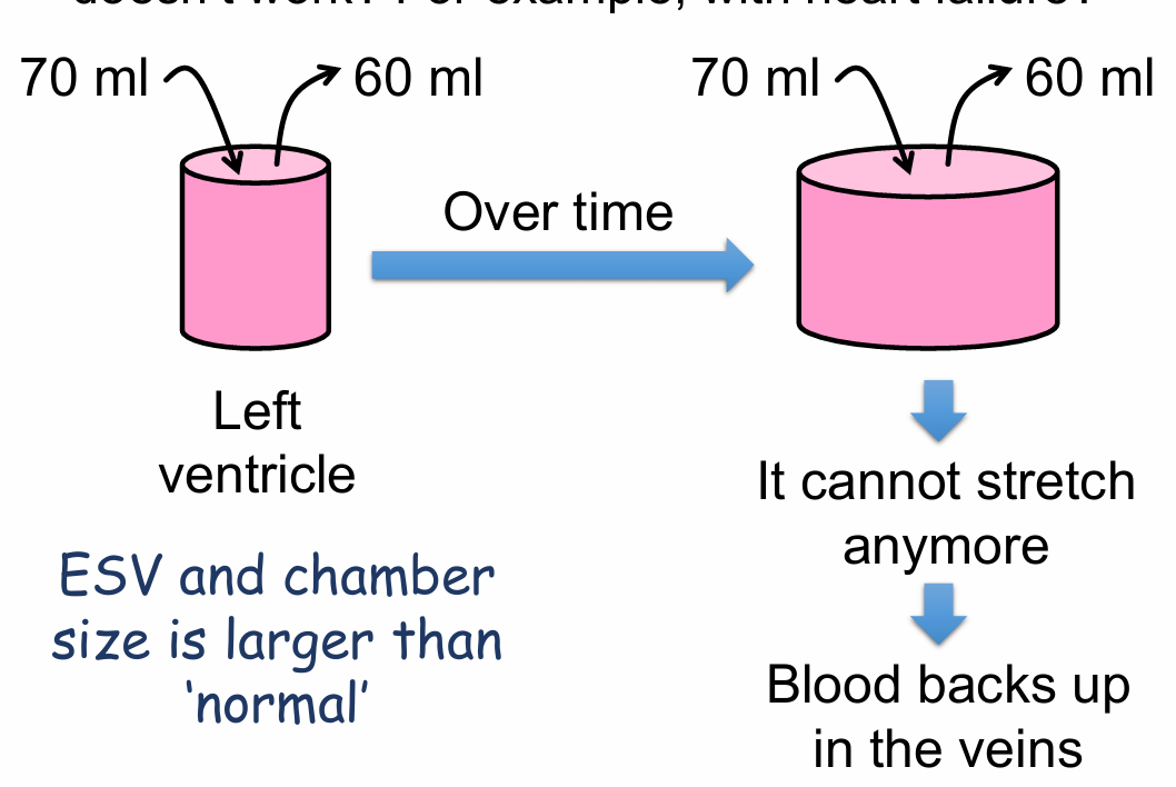 <ul><li><p>ESV and chamber size is larger than normal</p></li><li><p>It cannot stretch anymore</p></li><li><p>Blood backs up in the veins</p></li></ul><p></p>