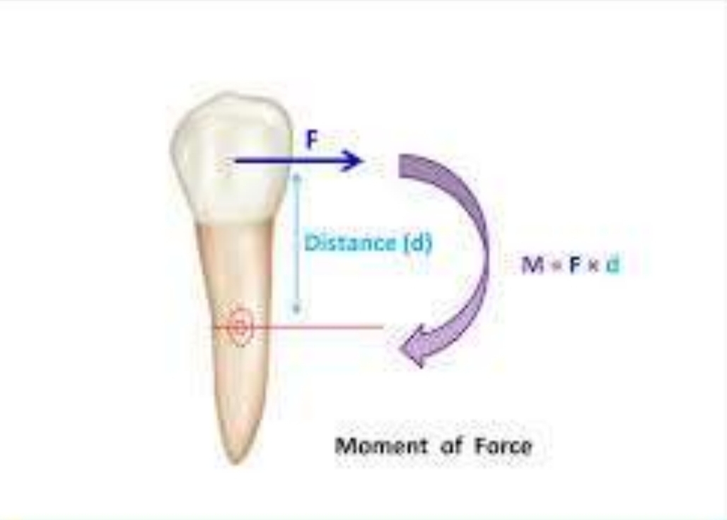 <p>Measure of a forces capacity to produce rotation</p><p class="has-focus">Moment = force x distance from CR</p><p class="has-focus">Important for controling rotation, torque, tipping</p>