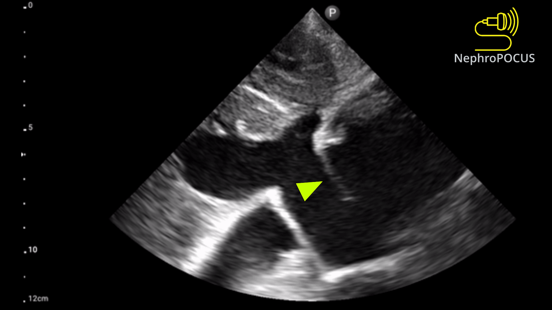 <p>What is seen in the 2D image?</p>