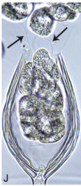 <p>Specialized structure used to produce and release spores (sporangium)</p>