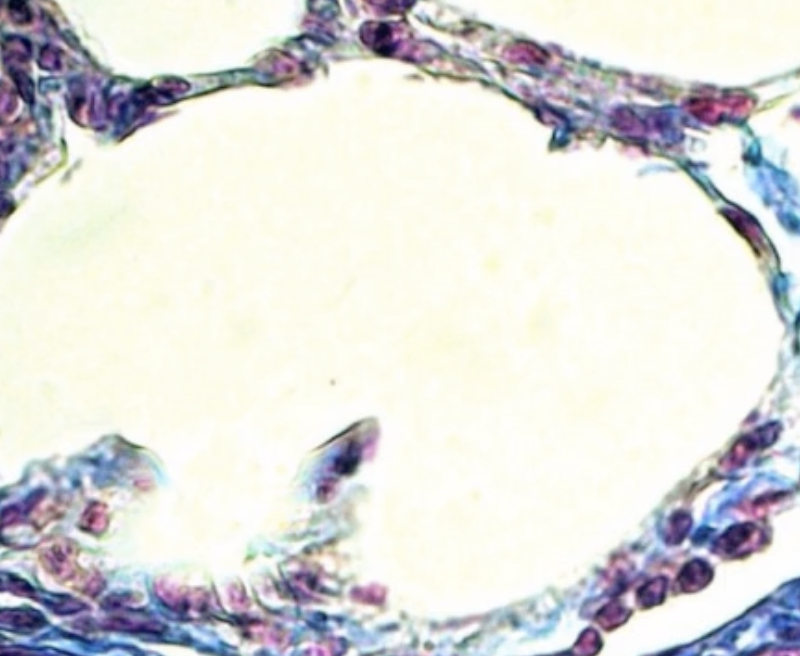 <p>What type of tissue does this image depict?</p>