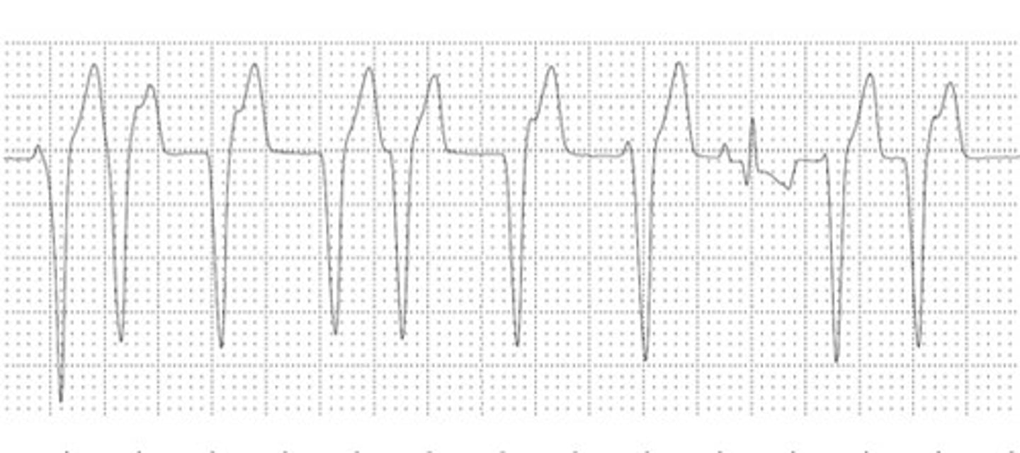 <p>What is the origin of this ECG?</p>