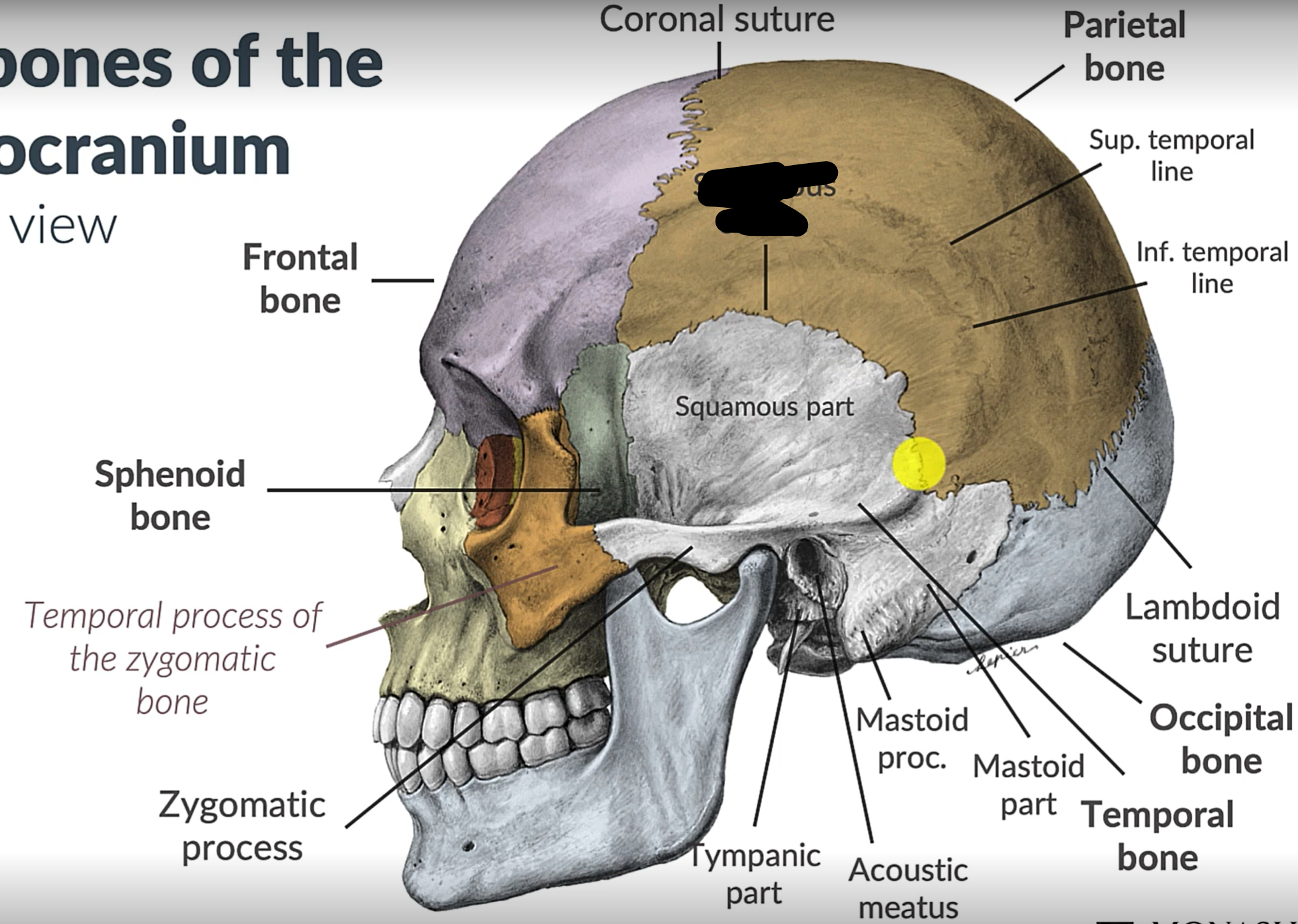 term image