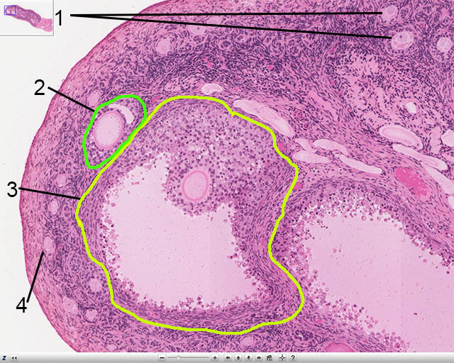 <p>what is this a slide of?</p>