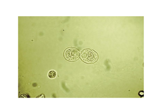 <p><span>Round or oval shaped,</span></p><p><span>smaller</span></p><p></p><p><span>May be mistaken for</span></p><p><span>WBCs or spherical</span></p><p><span>transitional cells</span></p><p></p><p><span>Observe the</span></p><p><span>eccentrically placed</span></p><p><span>nucleus to differentiate</span></p><p><span>from spherical</span></p><p><span>transitional</span></p>