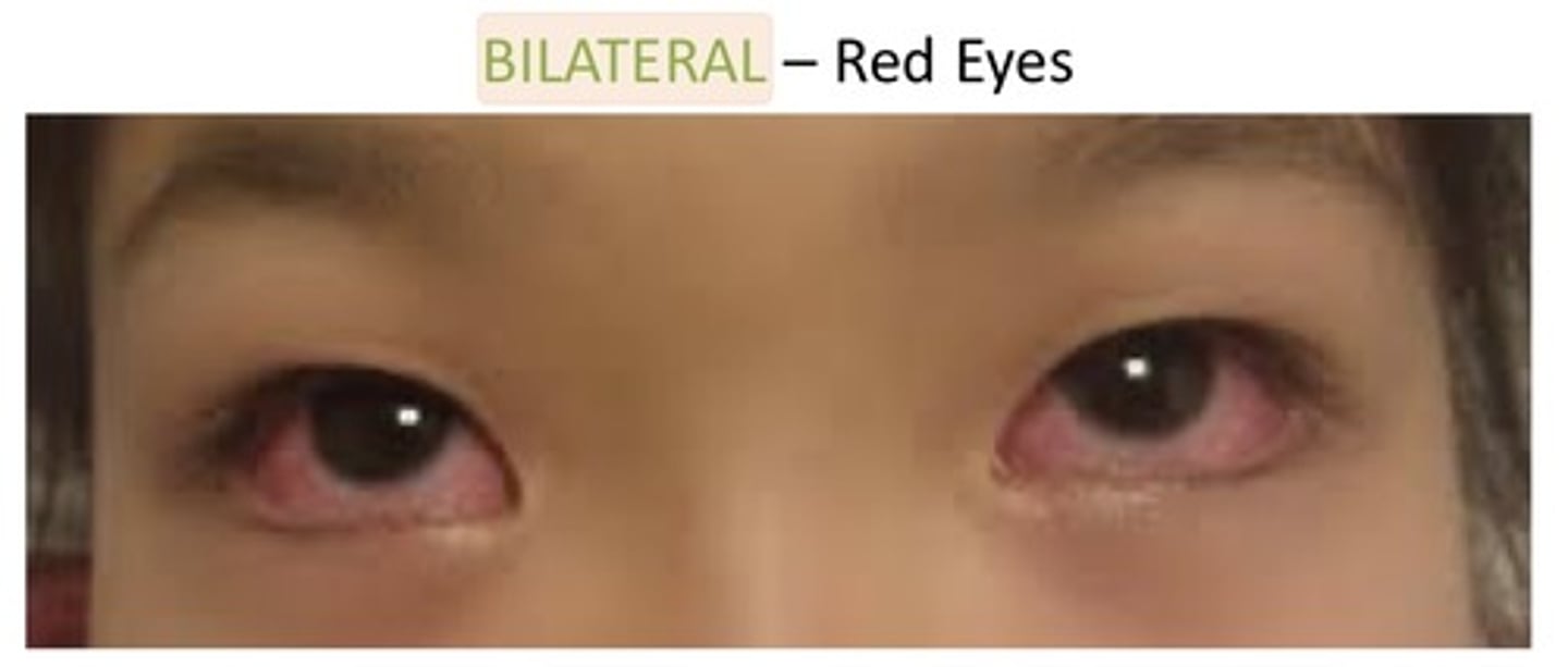 <p>1. Both sides of an anatomic structure</p><p>2. Used to describe if both eyes are red</p><p>3. Used to describe if both sides of the body are weak</p>
