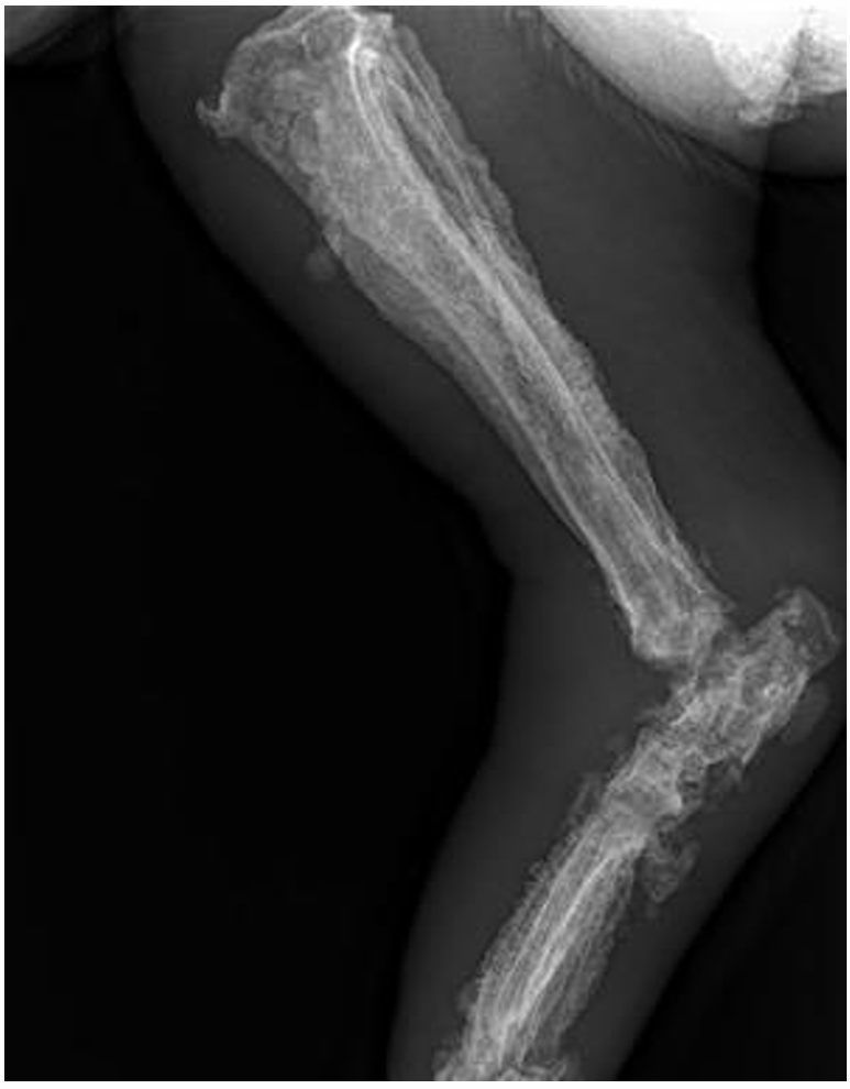 <p>What condition can we see here?</p>