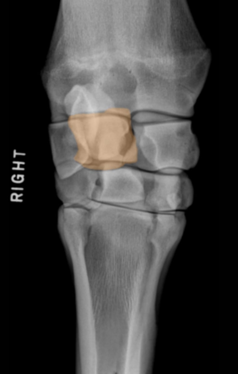 <p>What bone is highlighted?</p>