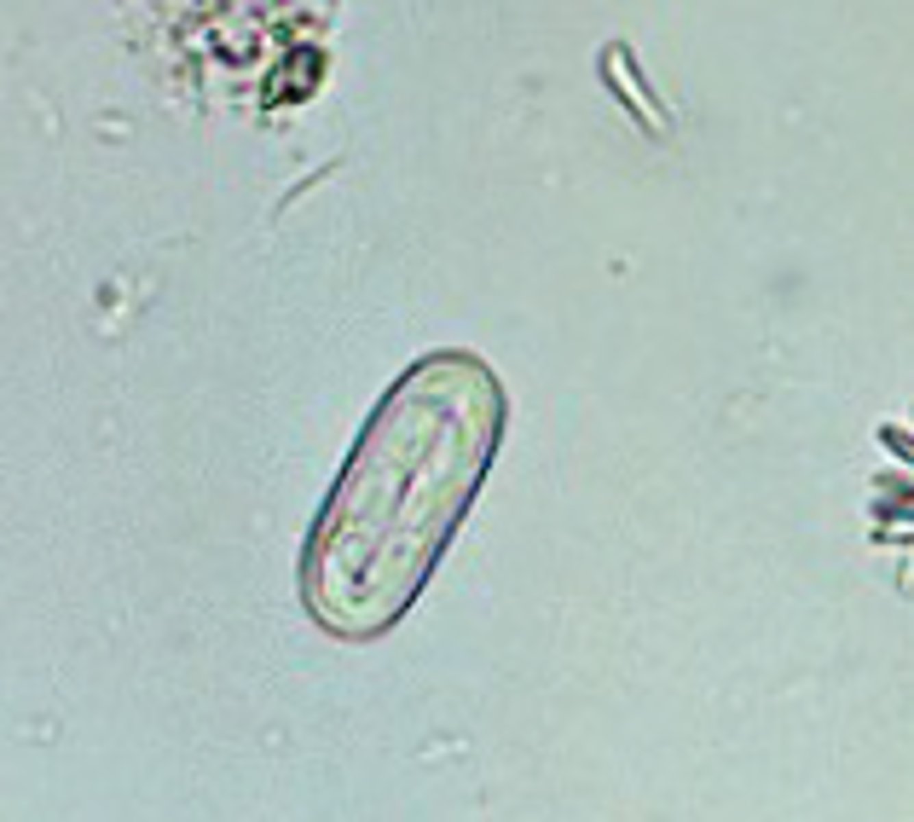 <p>esophageal worm; infects canines and felines; "paper clip" shaped egg</p>