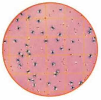 * typically 2-3 mm wide
* transparent, off-white
* foul-smelling
* quite wet-looking
* stains as small (almost too small to see) Gram-negative rods
* common in human intestines and in sewage