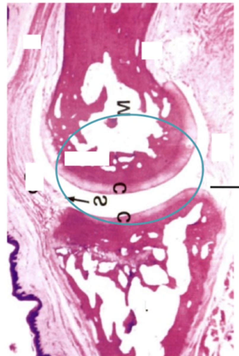 <p>What type of joint is shown?</p>