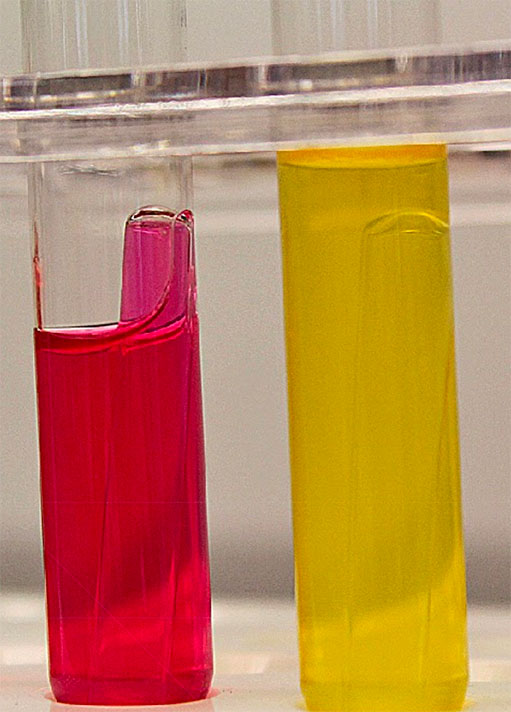 <p><span><span>The Phenol Red broth (PRB) test detects glucose fermentation in acidic products and is used to classify bacteria based on this result for an unknown organism. Here are the results of your PRB test. The broth on the left is your sample, compared to a control reaction on the right. Durham tubes can be disregarded, as no gas production is noted. What can you conclude?</span></span></p>