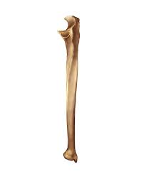 <p>What bone is this?</p>