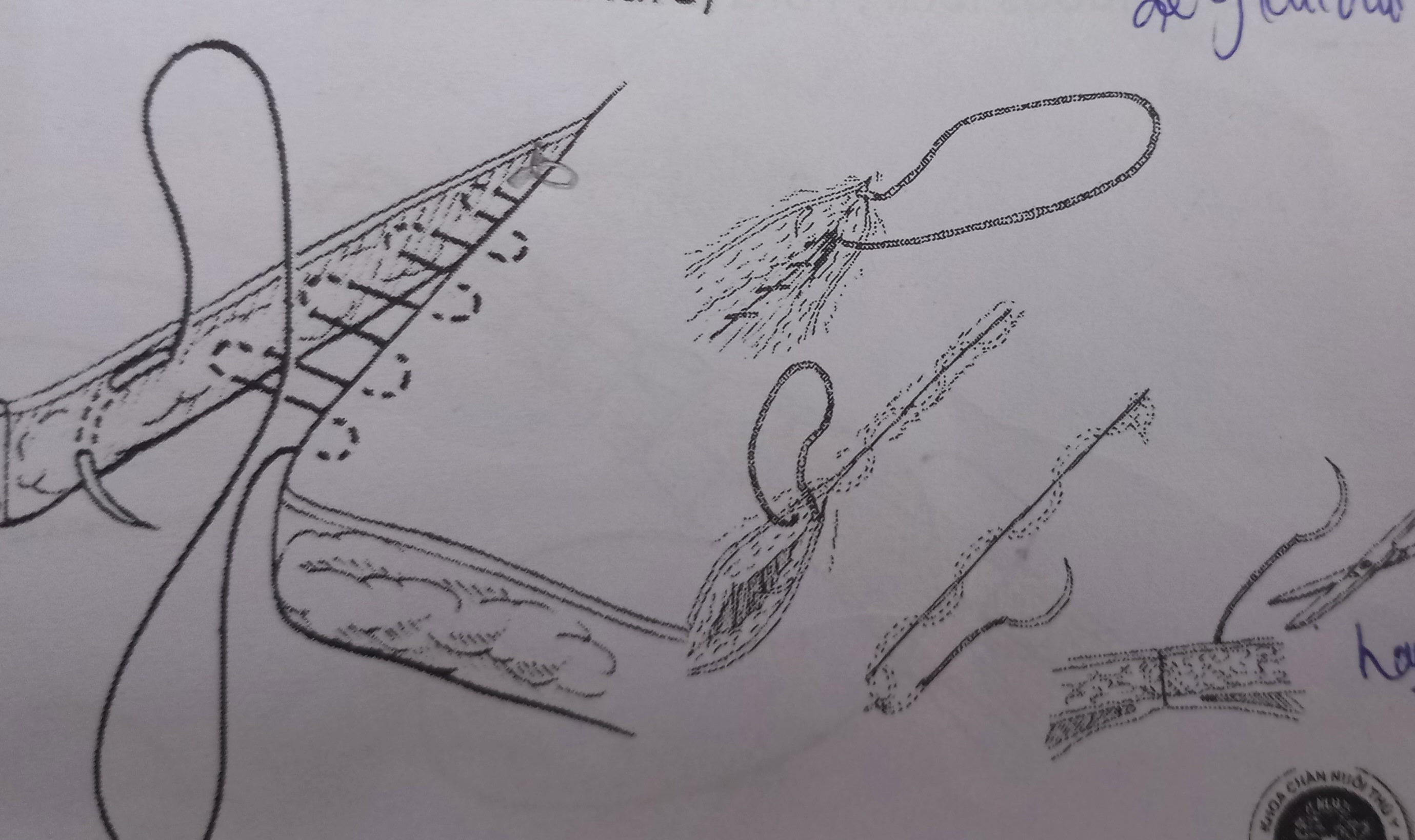 <p>May dưới da ltuc</p>