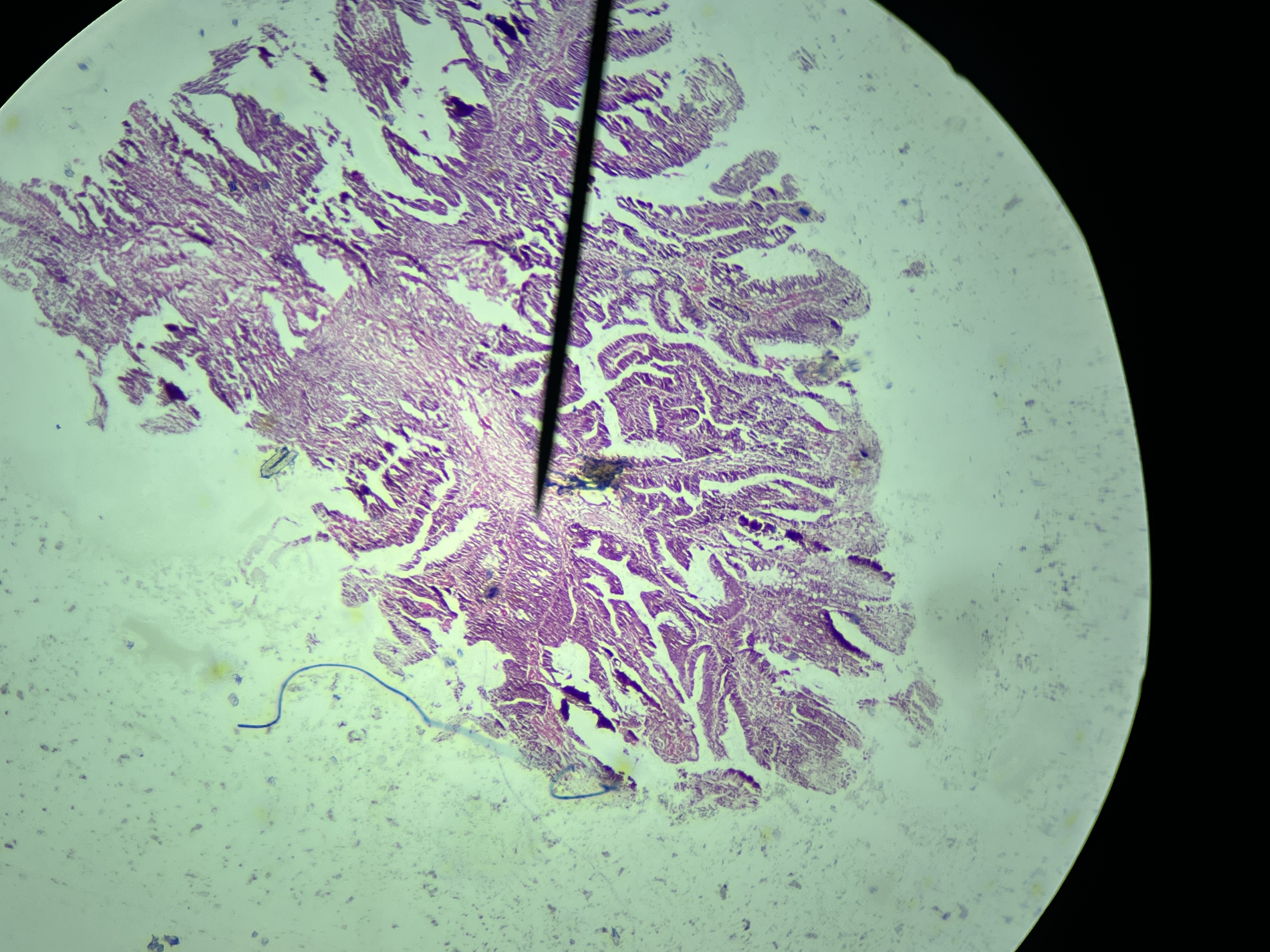 <p>What is the diagnosis?</p>