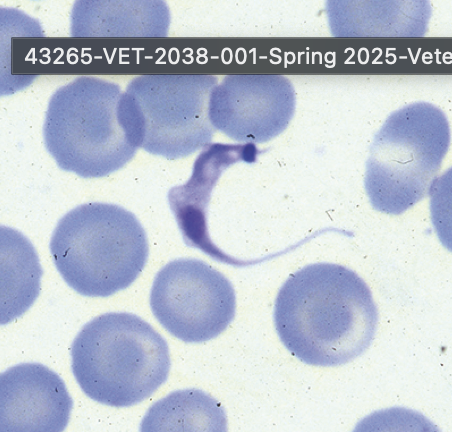 <p><em>Trypanosoma cruzi</em> - Chagas disease (trypomastigote)</p>