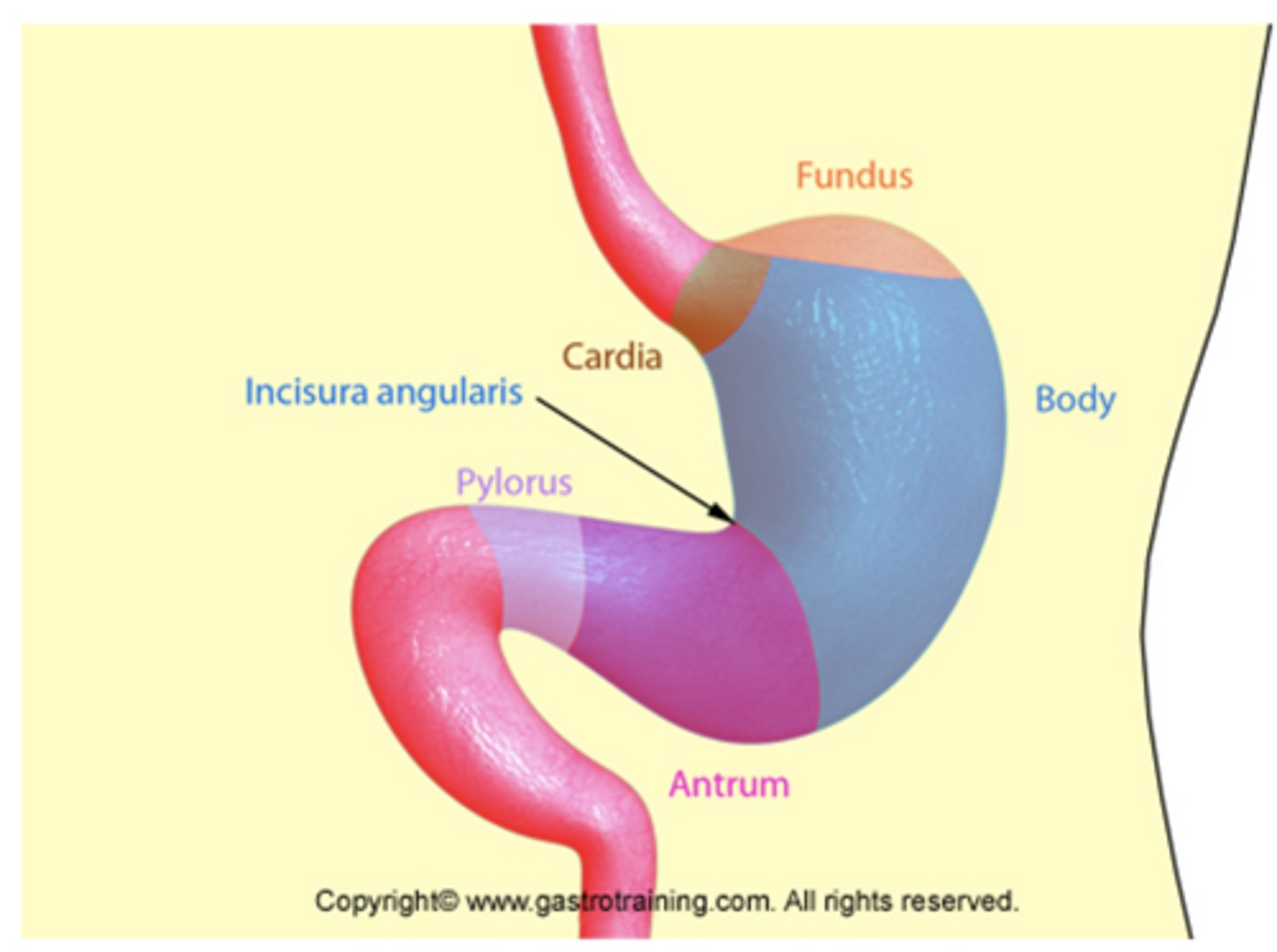 <p>How does the severity of gastritis from H. pylori infection vary throughout the stomach?</p>