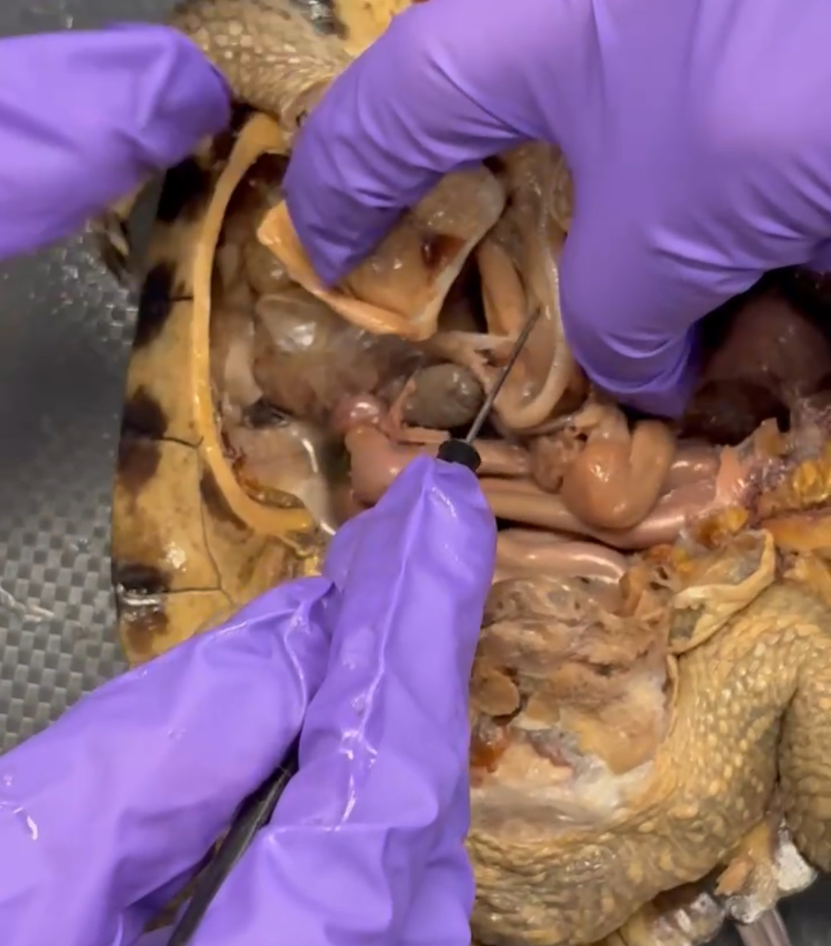 <p>Under trachea</p>