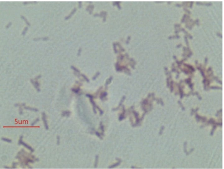 <p>What is the phylum of Escherichia coli?</p>