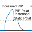 <p>What does this waveform indicate?</p>