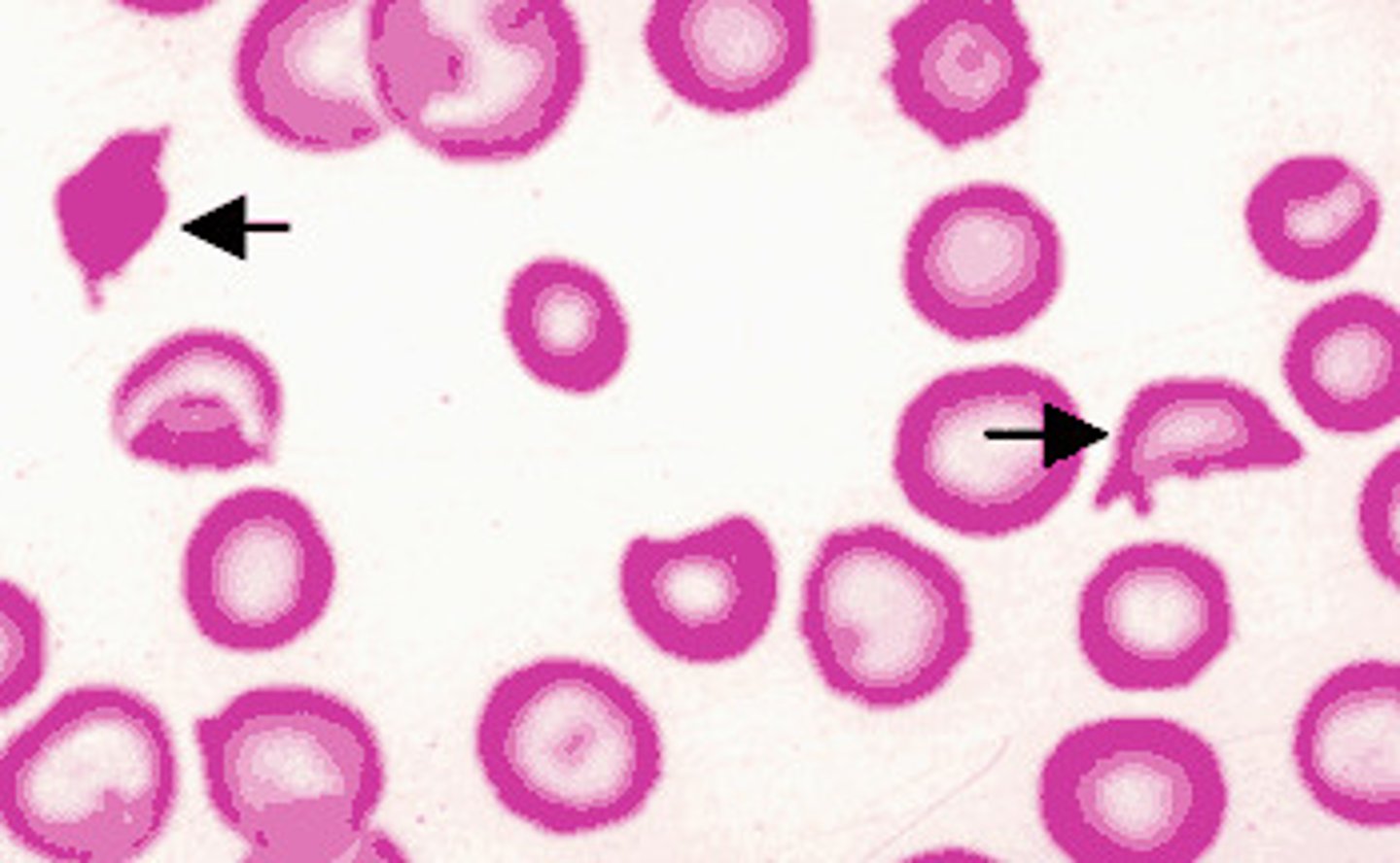 <p>fragmented red blood cells formed because of shearing</p>