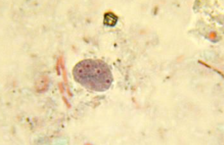 <p>Identify the organism and stage</p>