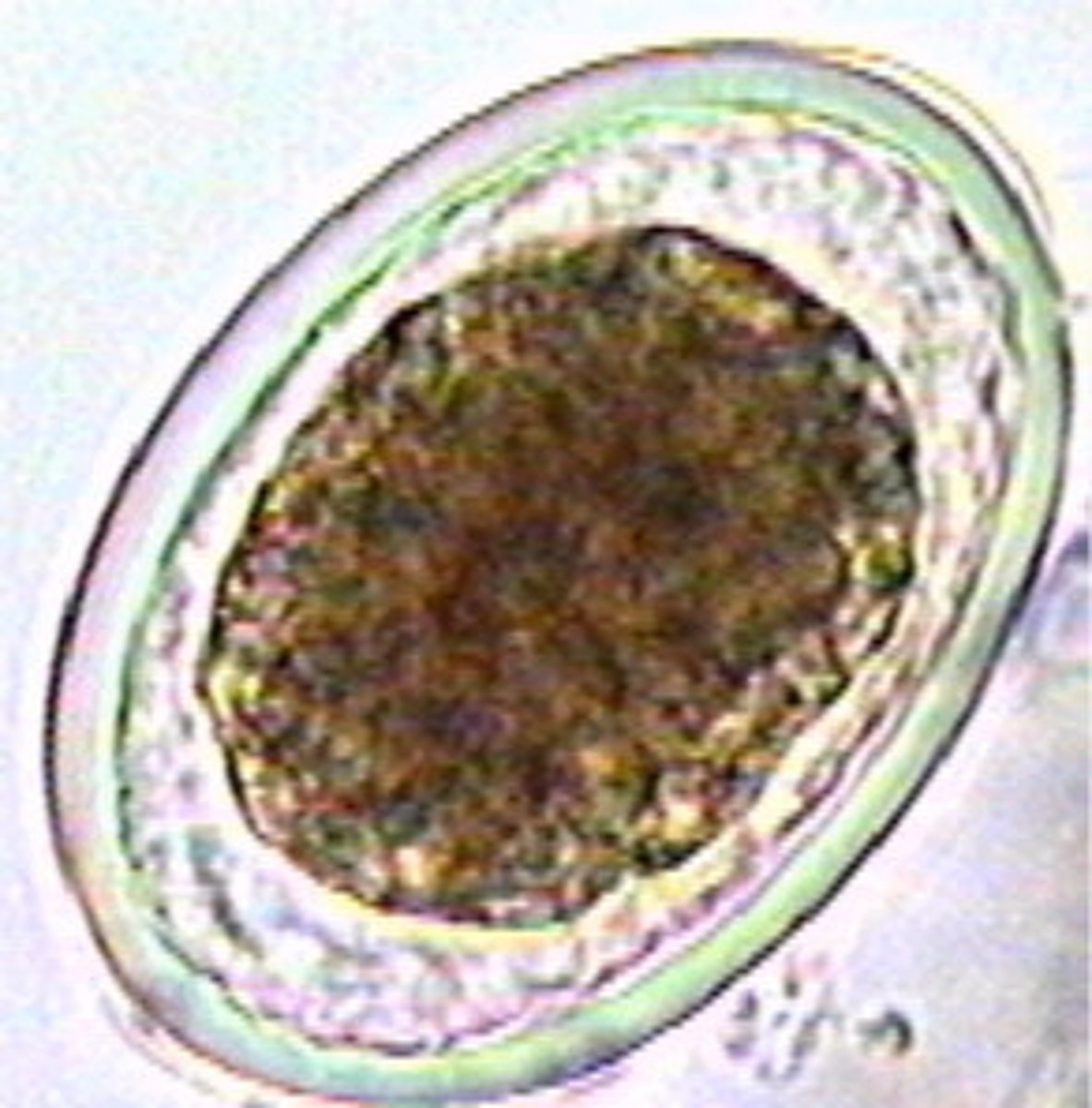 <p>what is this picture showing?</p>