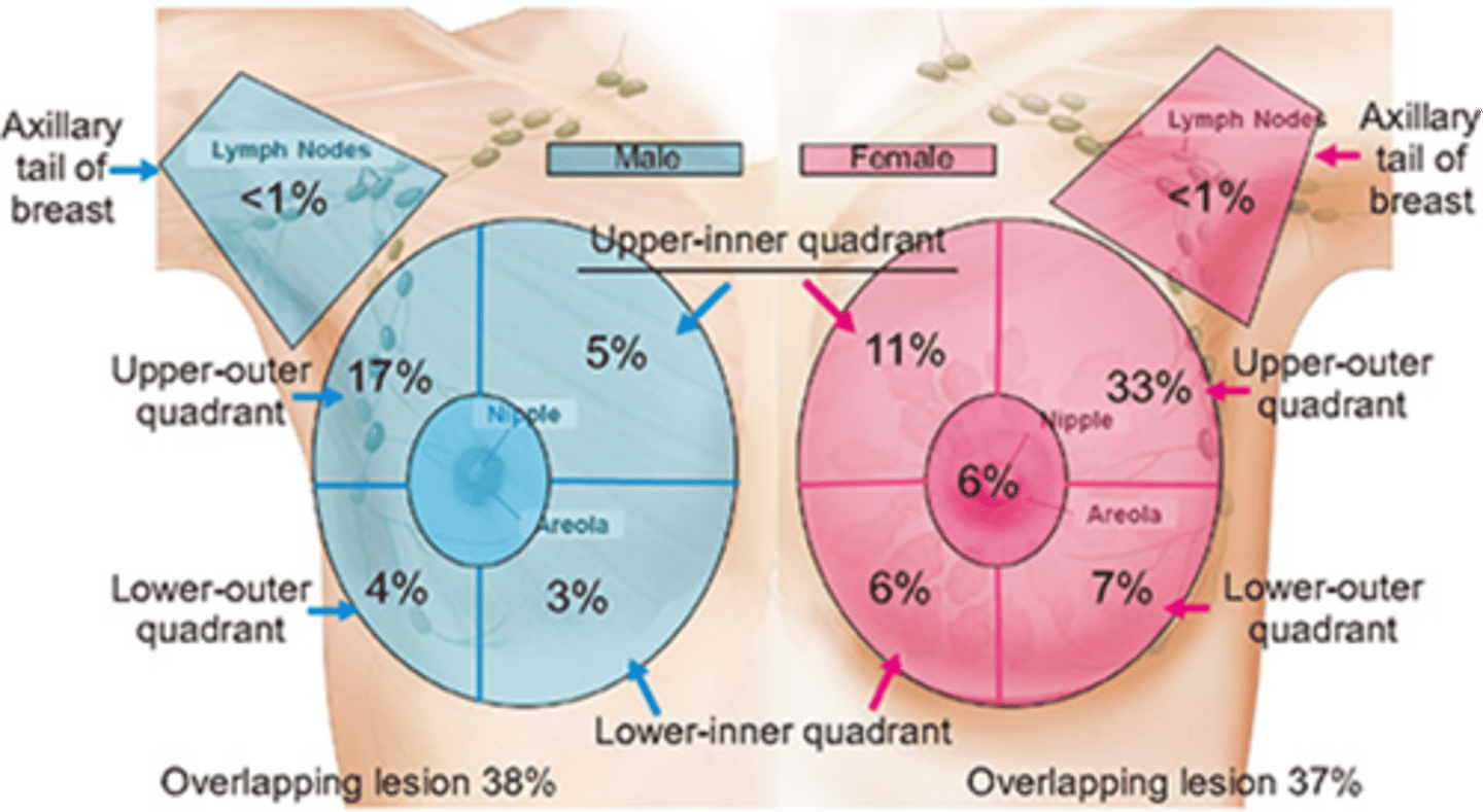 <p>upper outer quadrants</p>