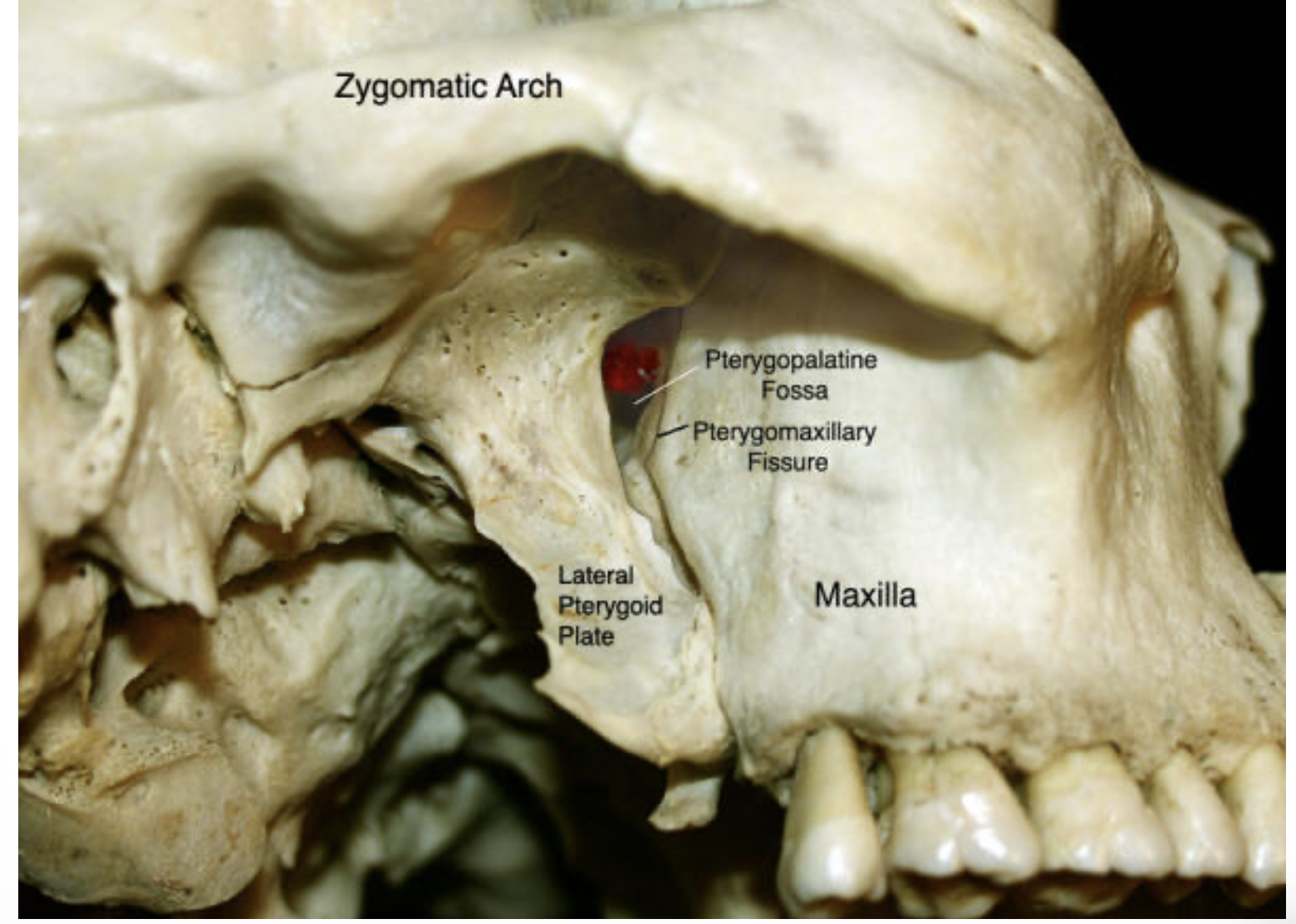 <p>pterygomaxillary fissure, lateral pterygoid plate of the sphenoid, pyramidal process of the palatine bone and pharynx</p>