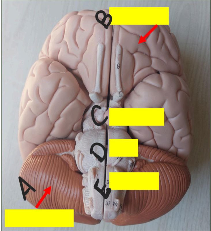 <p>Identify the following</p>