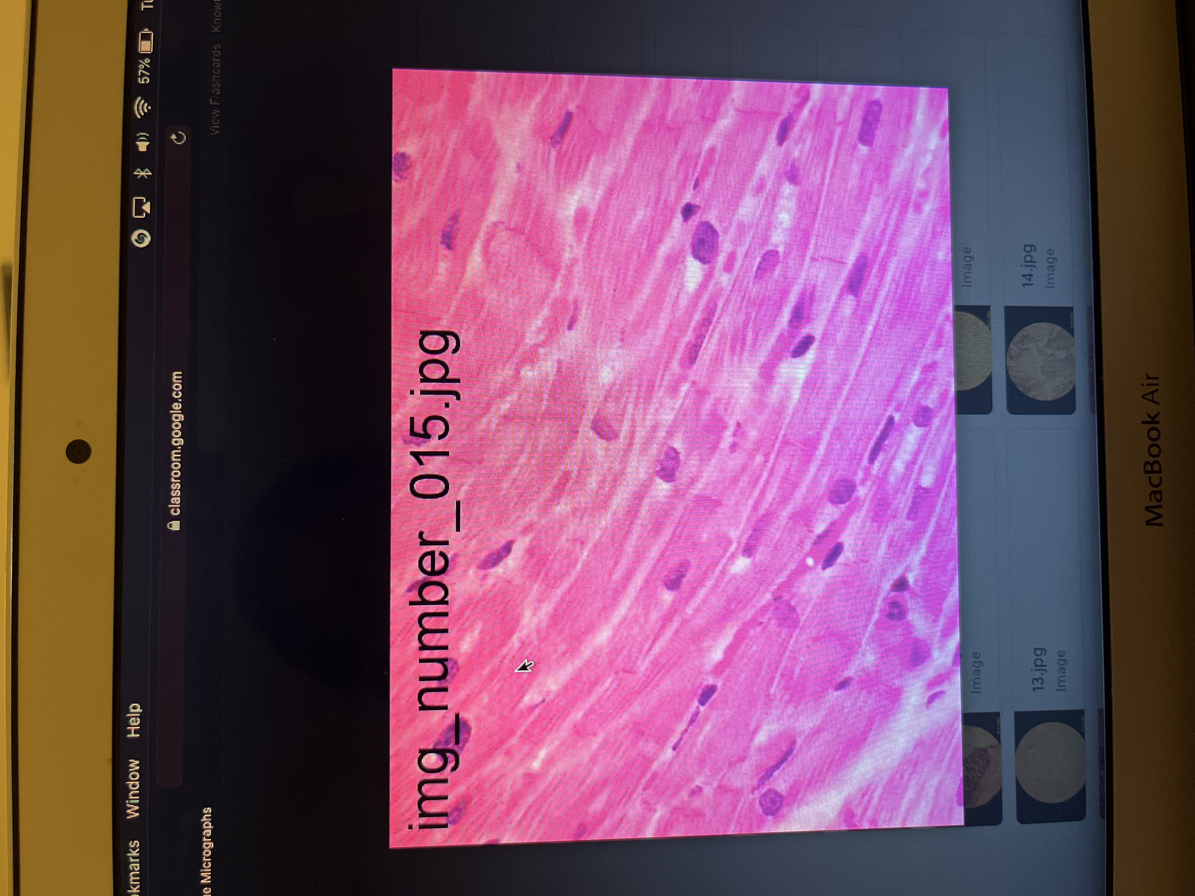 Location: iris of eyes, hollow internal structures 
Function: motion 