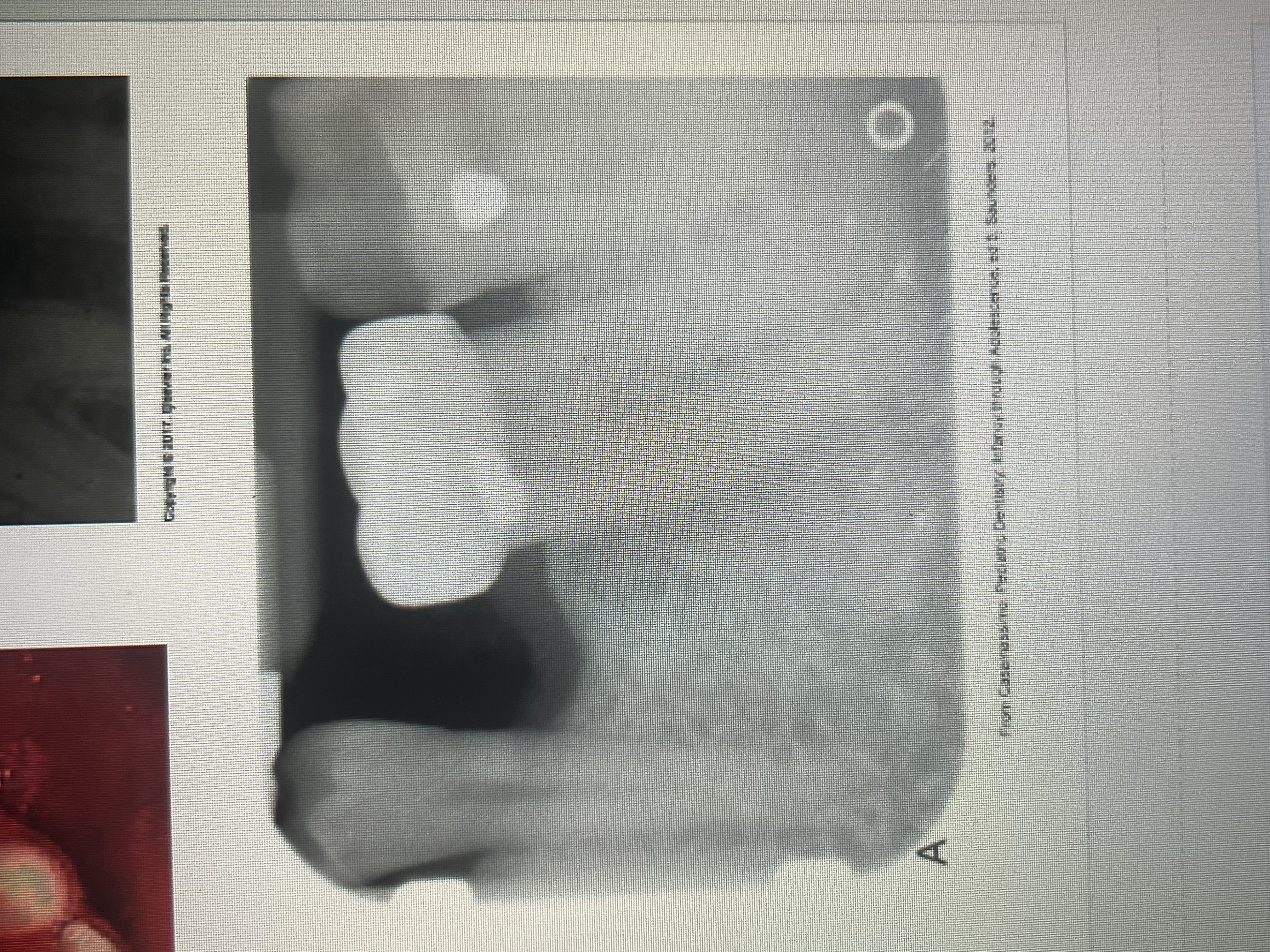 <p>Radiopaque with smooth and regular margins. Appear see through</p>