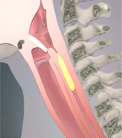<p>Involuntary </p><p>The bolus is transported down the esophagus into the stomach during the esophageal phase </p><p>Swallowing involves peristaltic (wavelike) movement of the bolus through the esophagus </p>