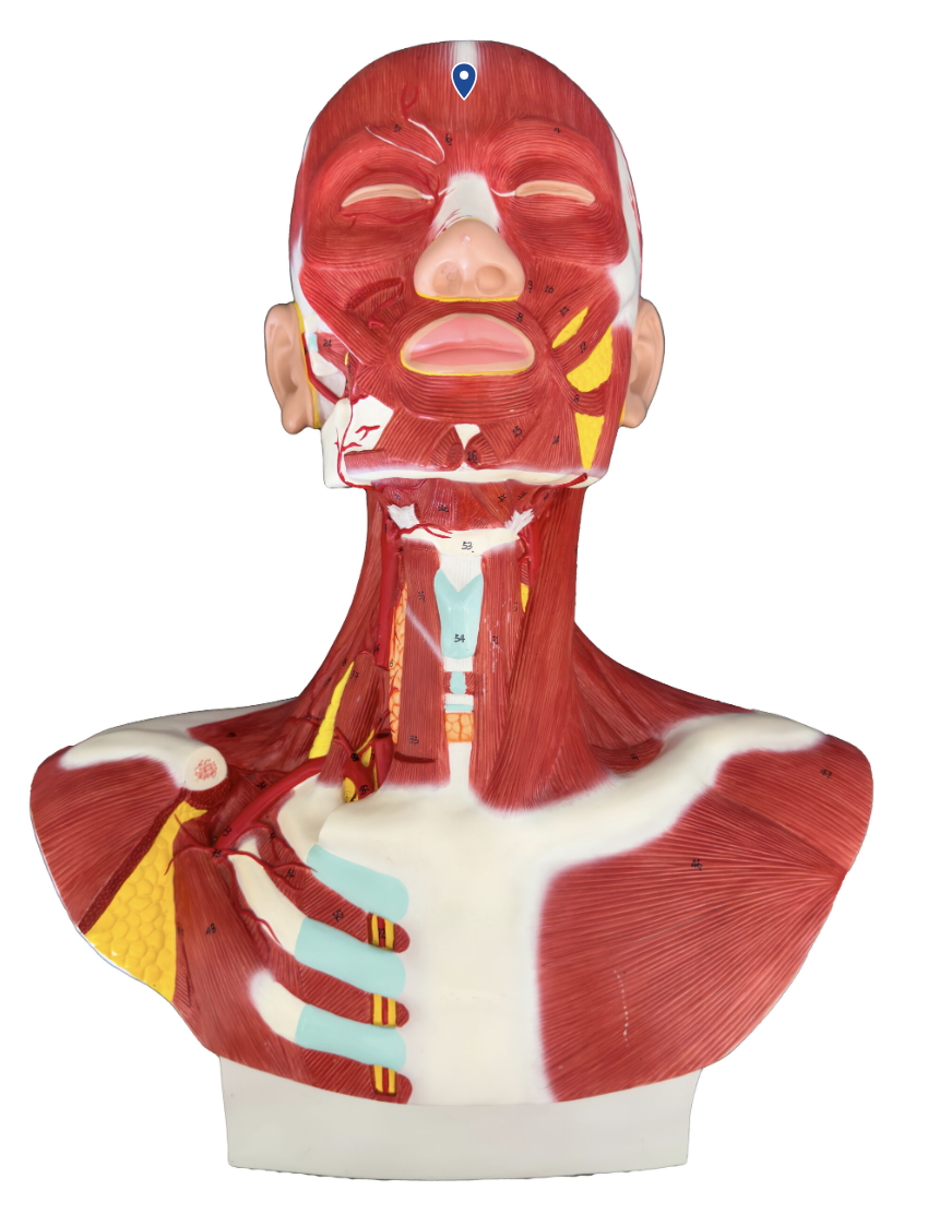 <p>What muscle is the arrow pointing to?</p>