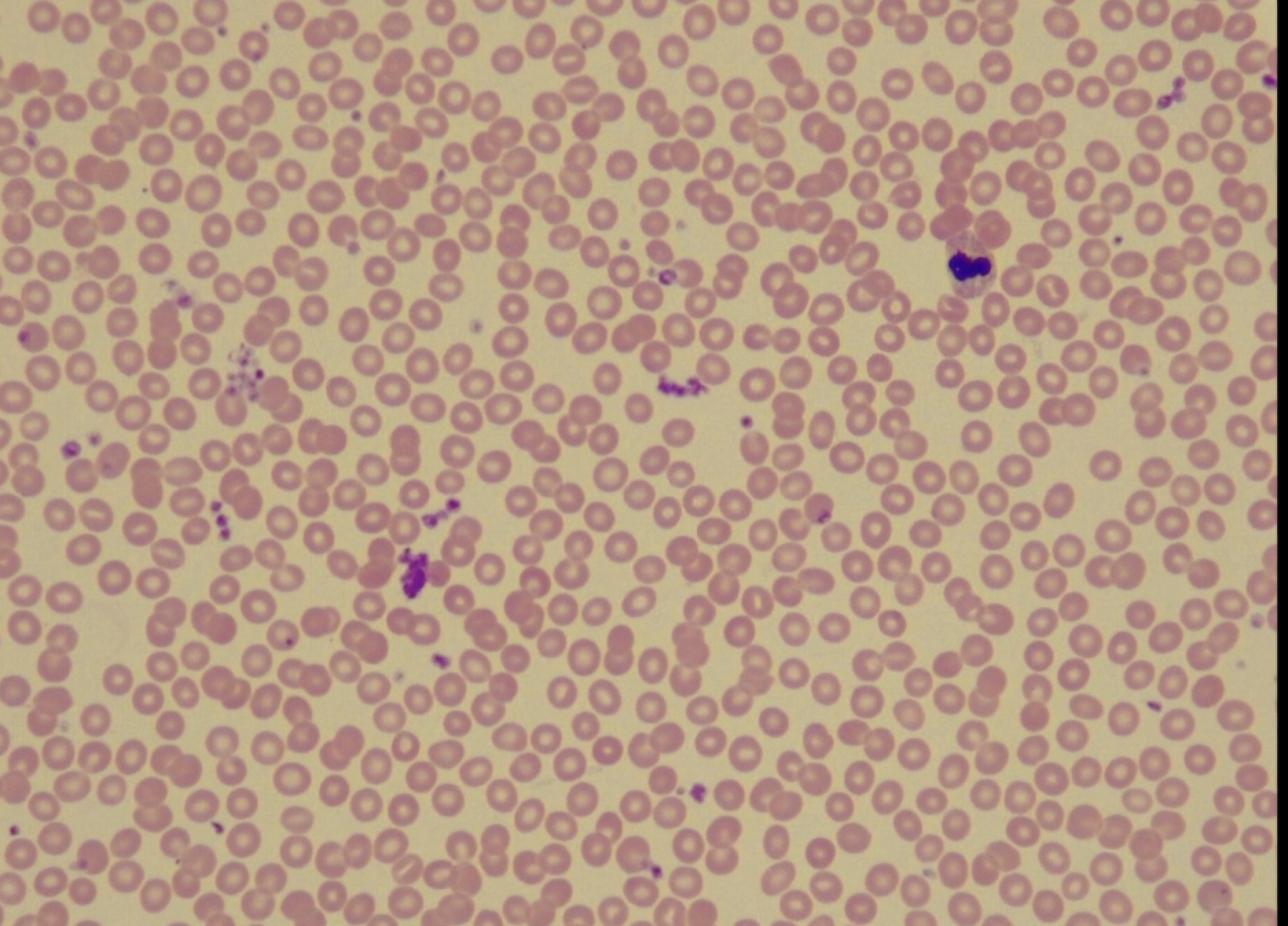 <p>Fluid ct (blood)</p>