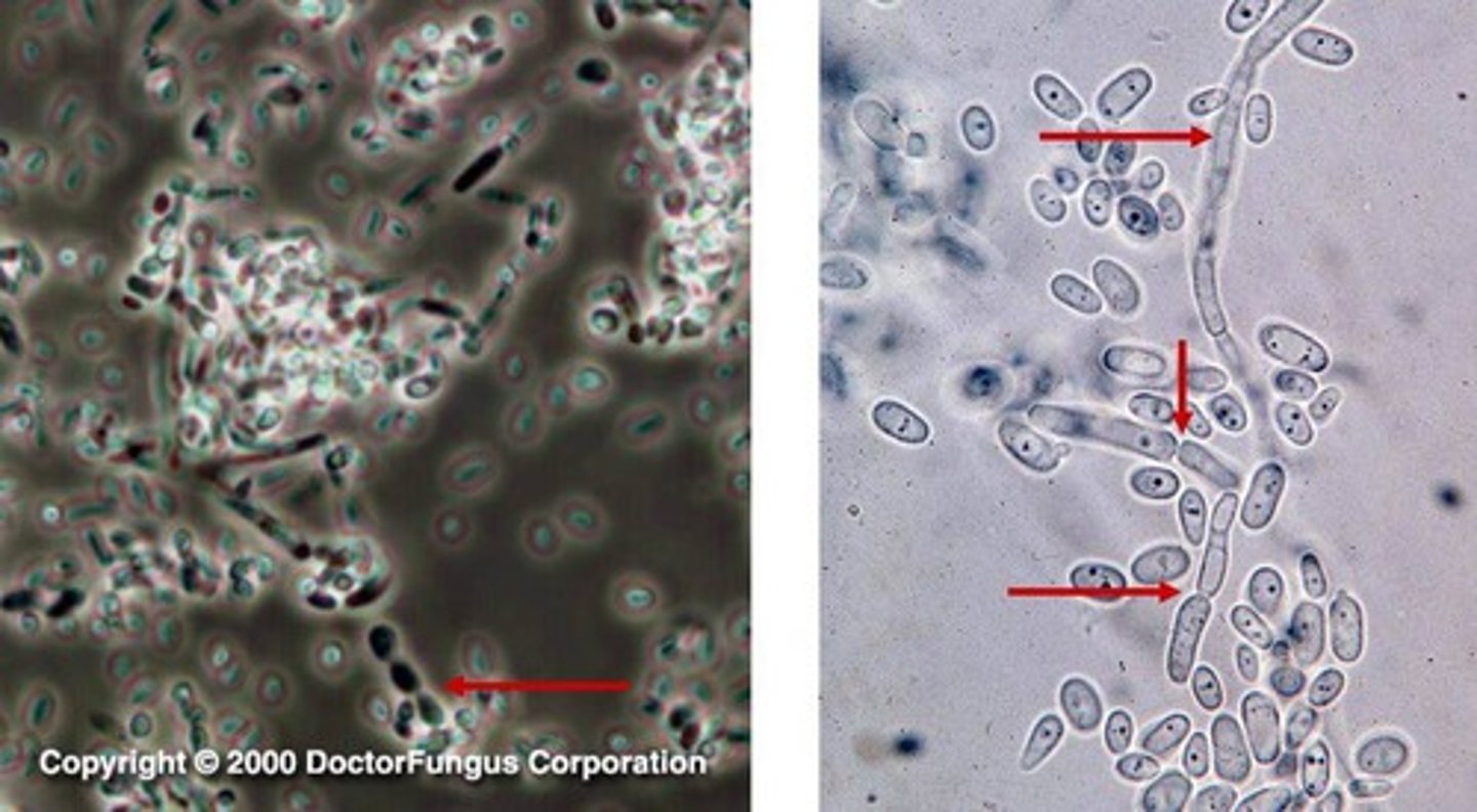 <p>Common bacterial etiologies; isolation of the microbe for ID &amp; antibiotic sensitivity</p>