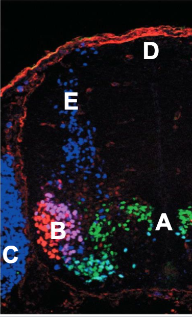 In this image of a newborn mouse spinal cord, three transcription factors are immunolabeled that are expressed in different neuronal subtypes. What letter is the closest to the anatomical location where NEPs first generate lower motor neurons at the earlier stages of neurogenesis? 