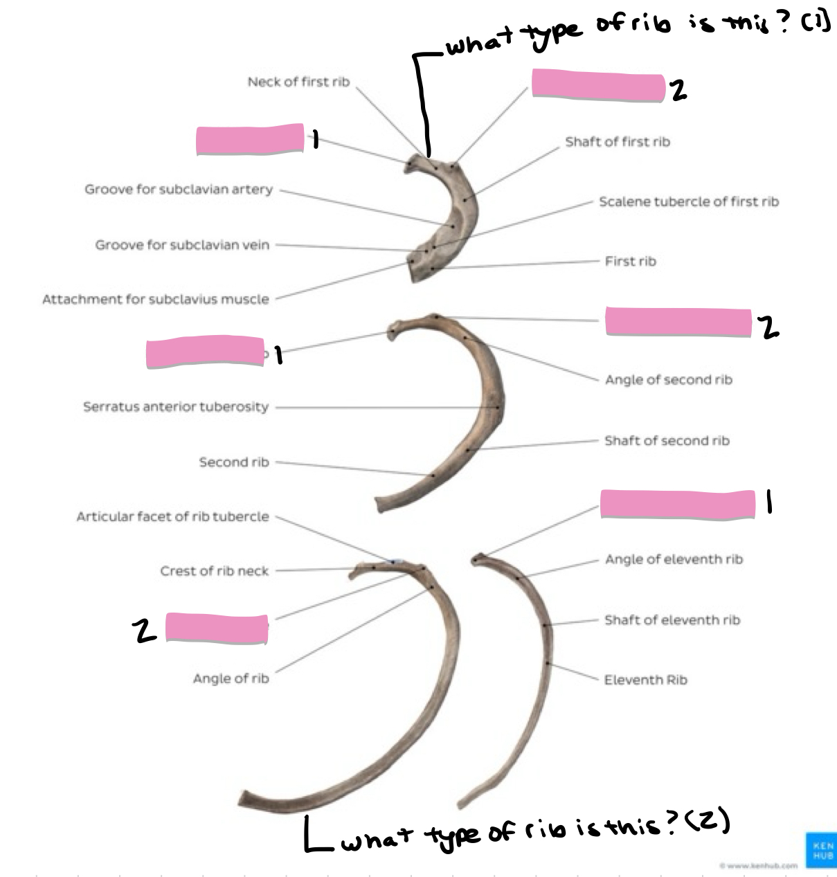 <p>What is #2?</p>